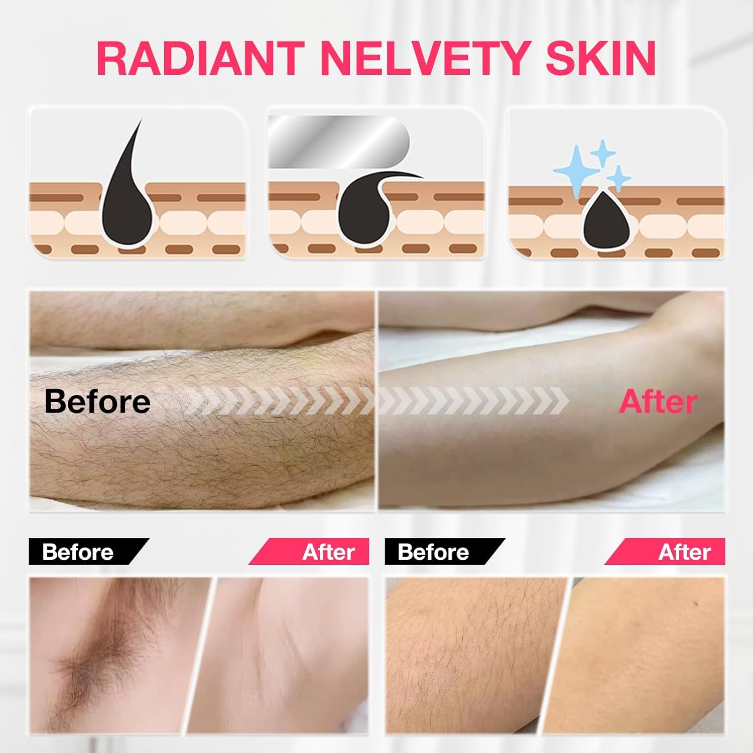 3.0 Nano Haarentferner,Crystal Haarentferner,Original Upgrade Haarentfernung Ohne Rasieren Wiederverwendbarer Crystal Hair Remover Magic Hair Radiergummi Für Frauen丨Männer Körper Beine Arme Rücken