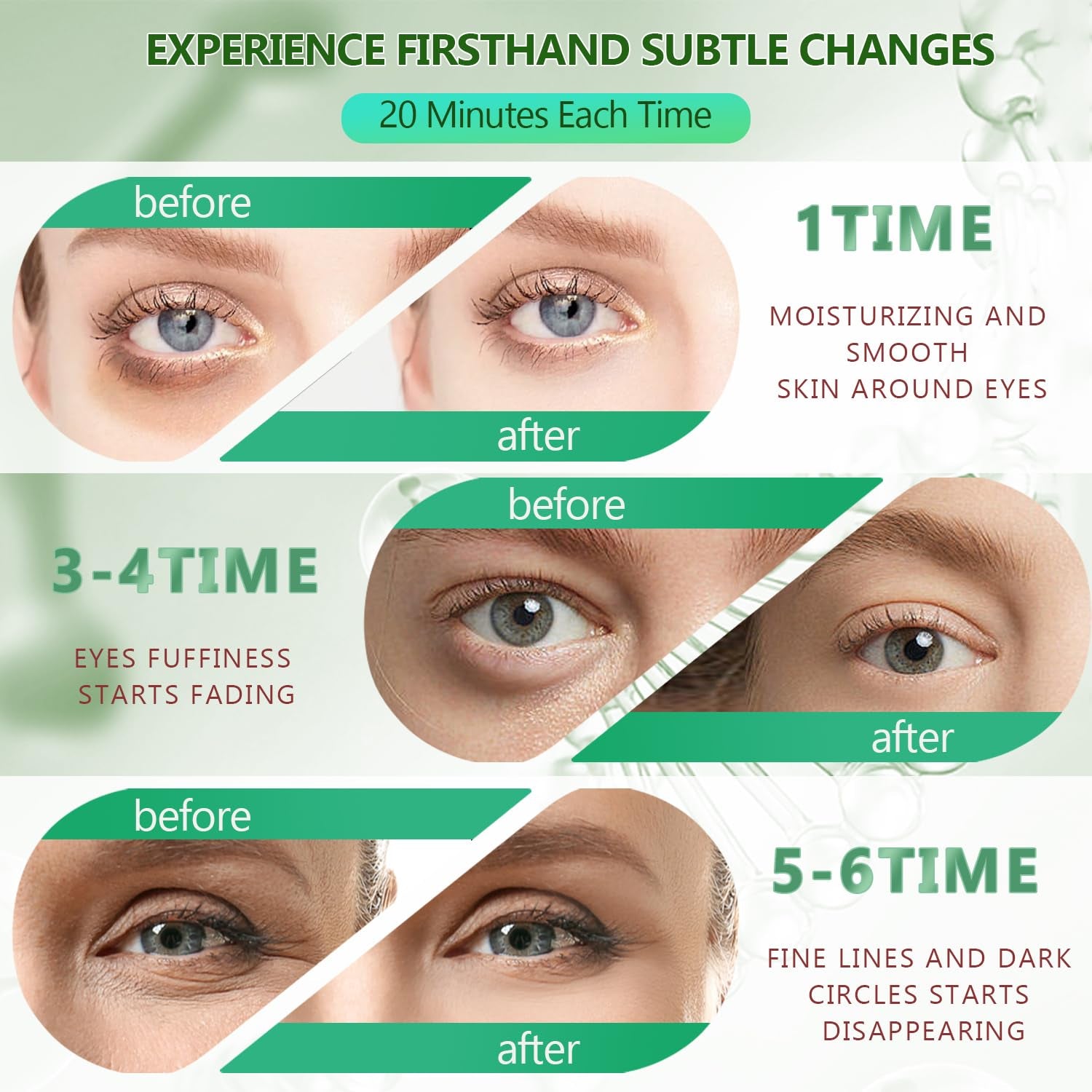 2 Stück 60 Pcs Hydration Feuchtigkeitsspendende Eye Pad Mask, Grün+24K Gold, 30 Paare Kollagen Hydrogel anti Aging Augenpads, Hyaluronsäure Augenmaske Dunkle Augenringe Entfernen, Kollagenaugenmaske