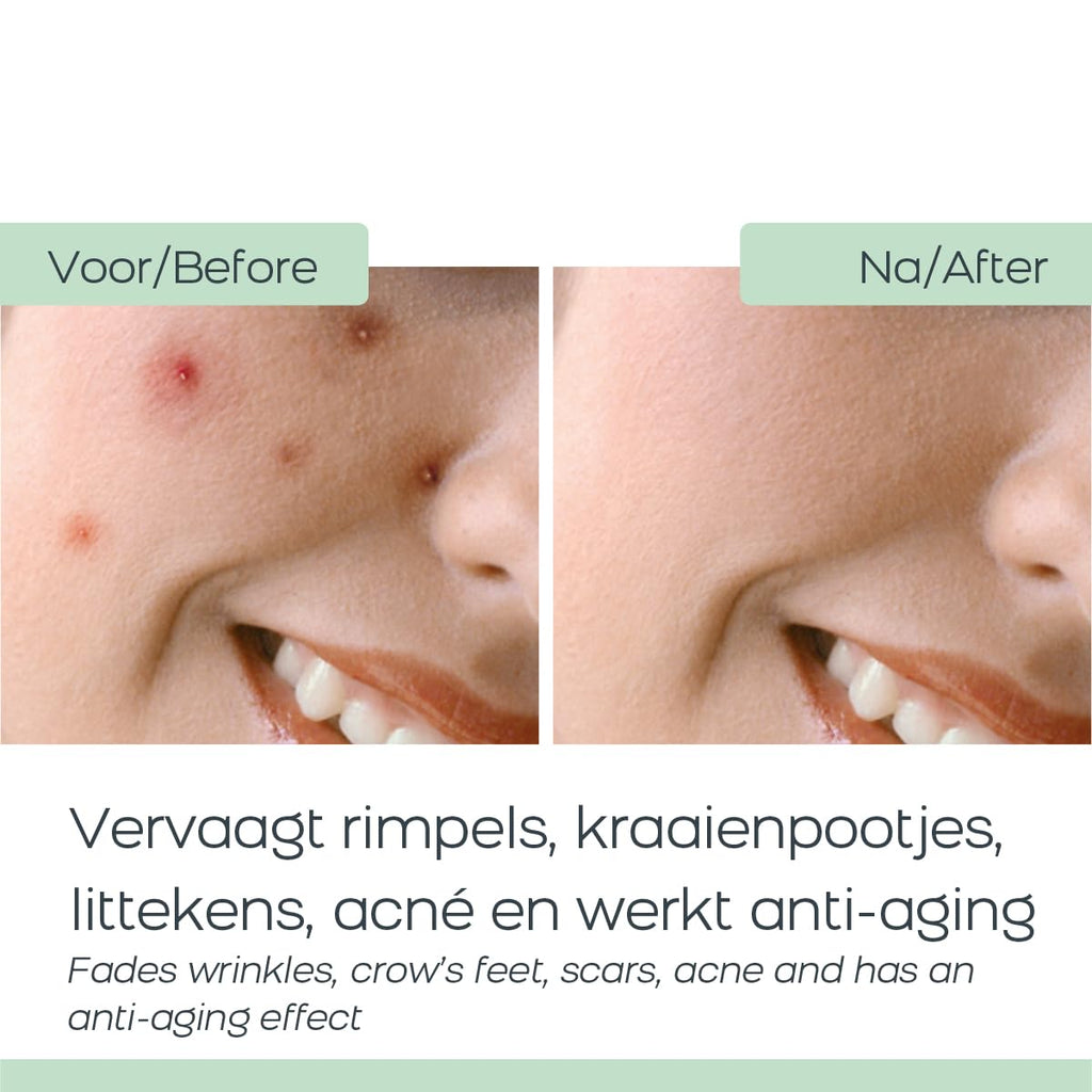 Orange Care Baba De Caracol Gesichtscreme Mit Schneckenschleim, Allantoin, Glykolsäure, Kollagen, Elastin, Schneckencreme - Schneckengel - Heilung & Weniger Akne, Narben, Anti-Aging (1)