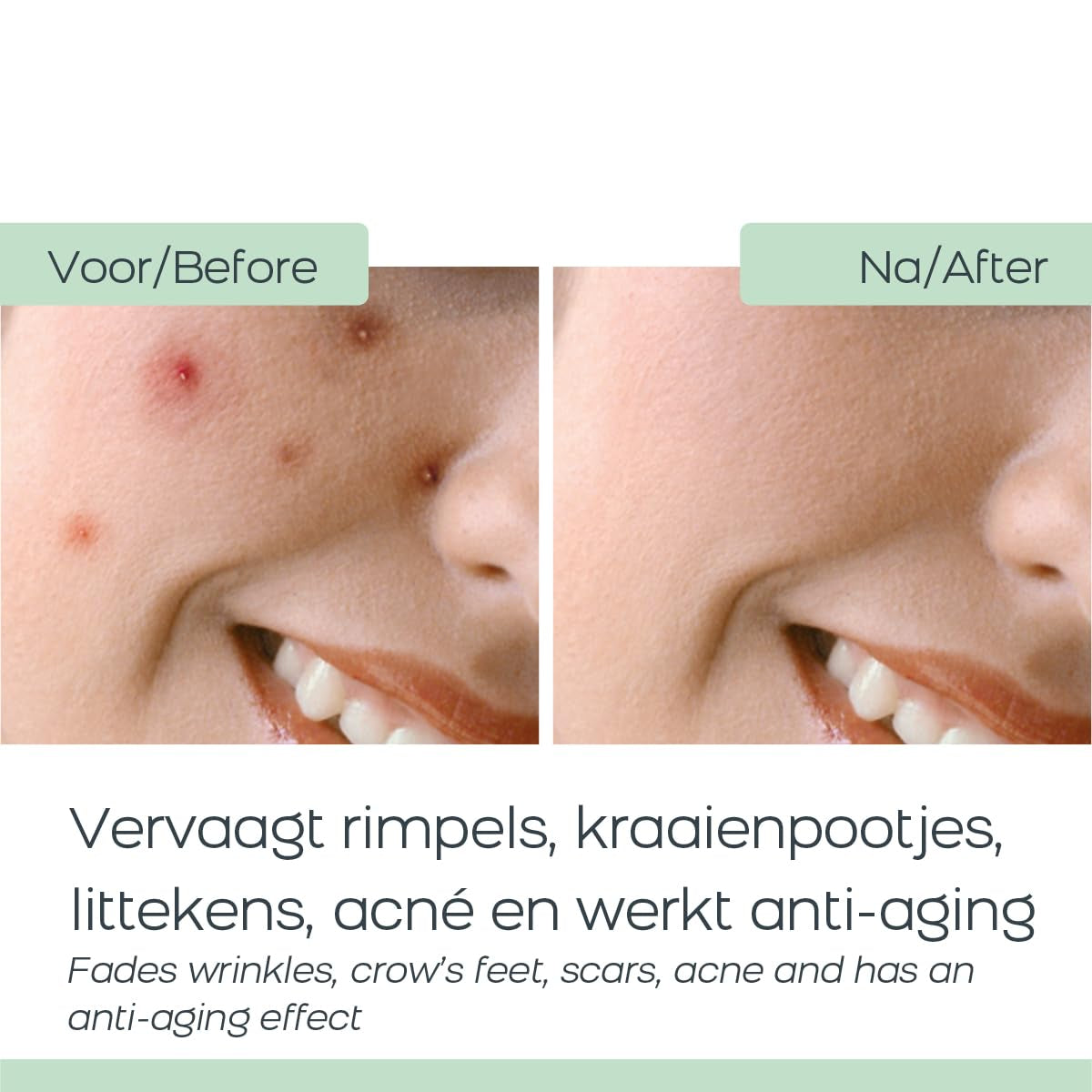 Orange Care Baba De Caracol Gesichtscreme Mit Schneckenschleim, Allantoin, Glykolsäure, Kollagen, Elastin, Schneckencreme - Schneckengel - Heilung & Weniger Akne, Narben, Anti-Aging (1)