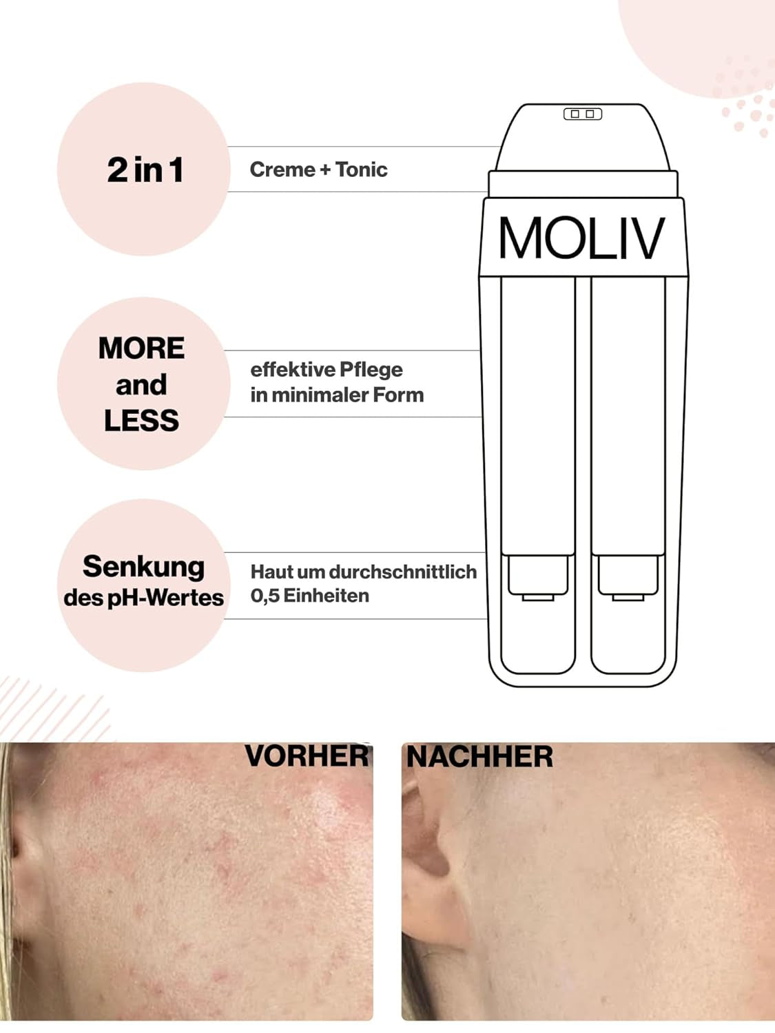 MOLIV Regenerierende Gesichtscreme, Feuchtigkeitsspendende Gesichtscreme, Nährende Gesichtscreme, Anti-Aging Gesichtscreme Mit Lebenden Probiotika (Feuchtigkeitsspendend)